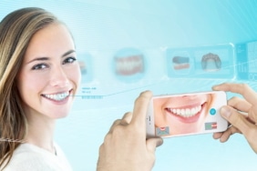 Dentacoin (DCN) nedir?