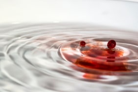 ripplea-darbe-koinmedya-com